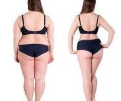 Chronic Disease Functional Medicine Vero Beach